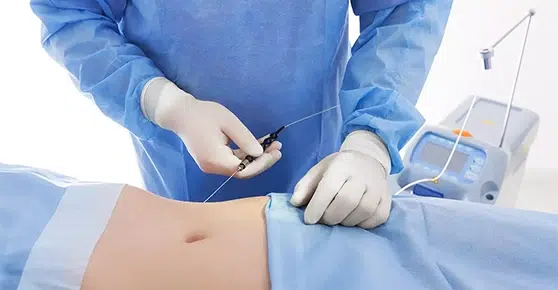 Interventions Chirurgie Esthétique en Tunisie