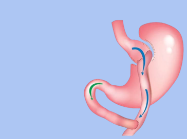 Interventions Chirurgie Esthétique en Tunisie