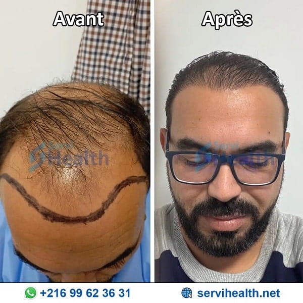 Vorher Nachher Fotos